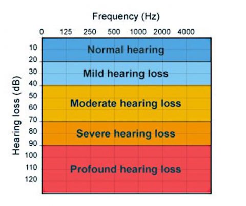 Hearing Loss | Best Hearing Aid Centre